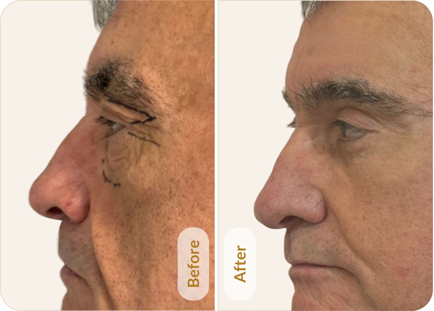 Risultato 2